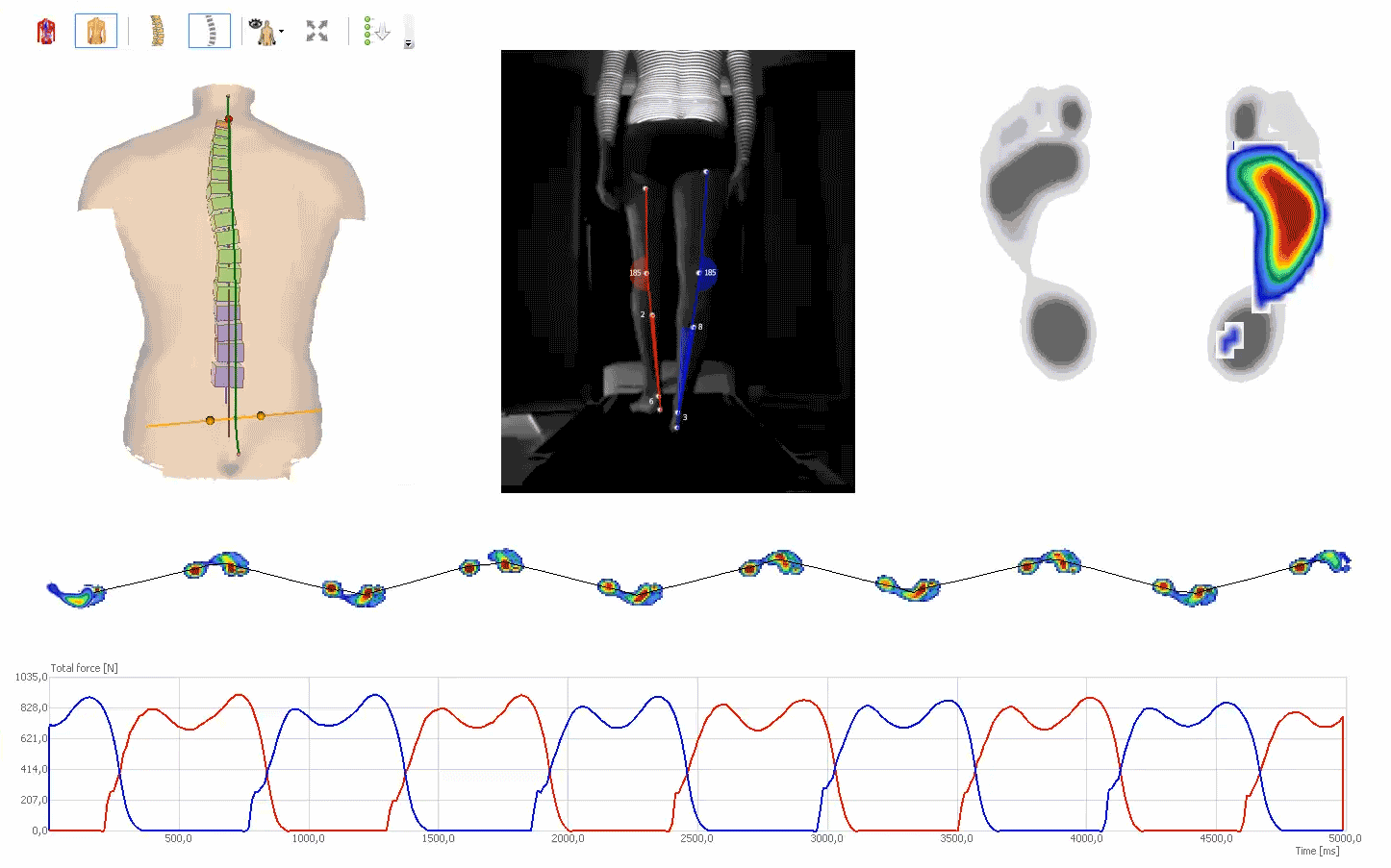 DIERS 4D motion® Lab