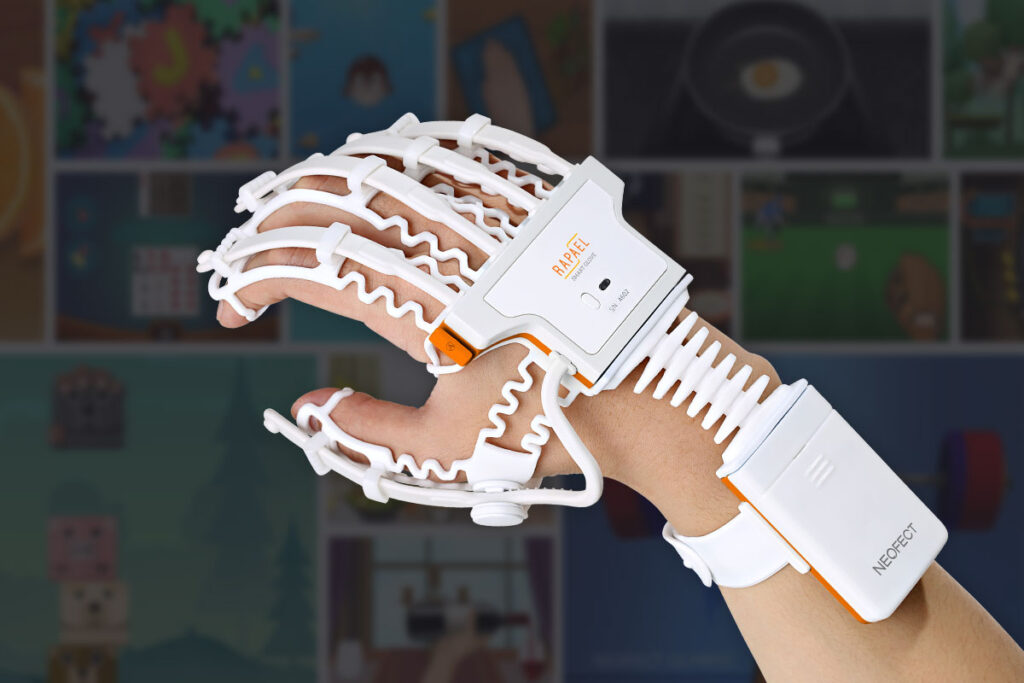 Neofect smart glove Реабілітація фуекціональності кисті після інсульту
