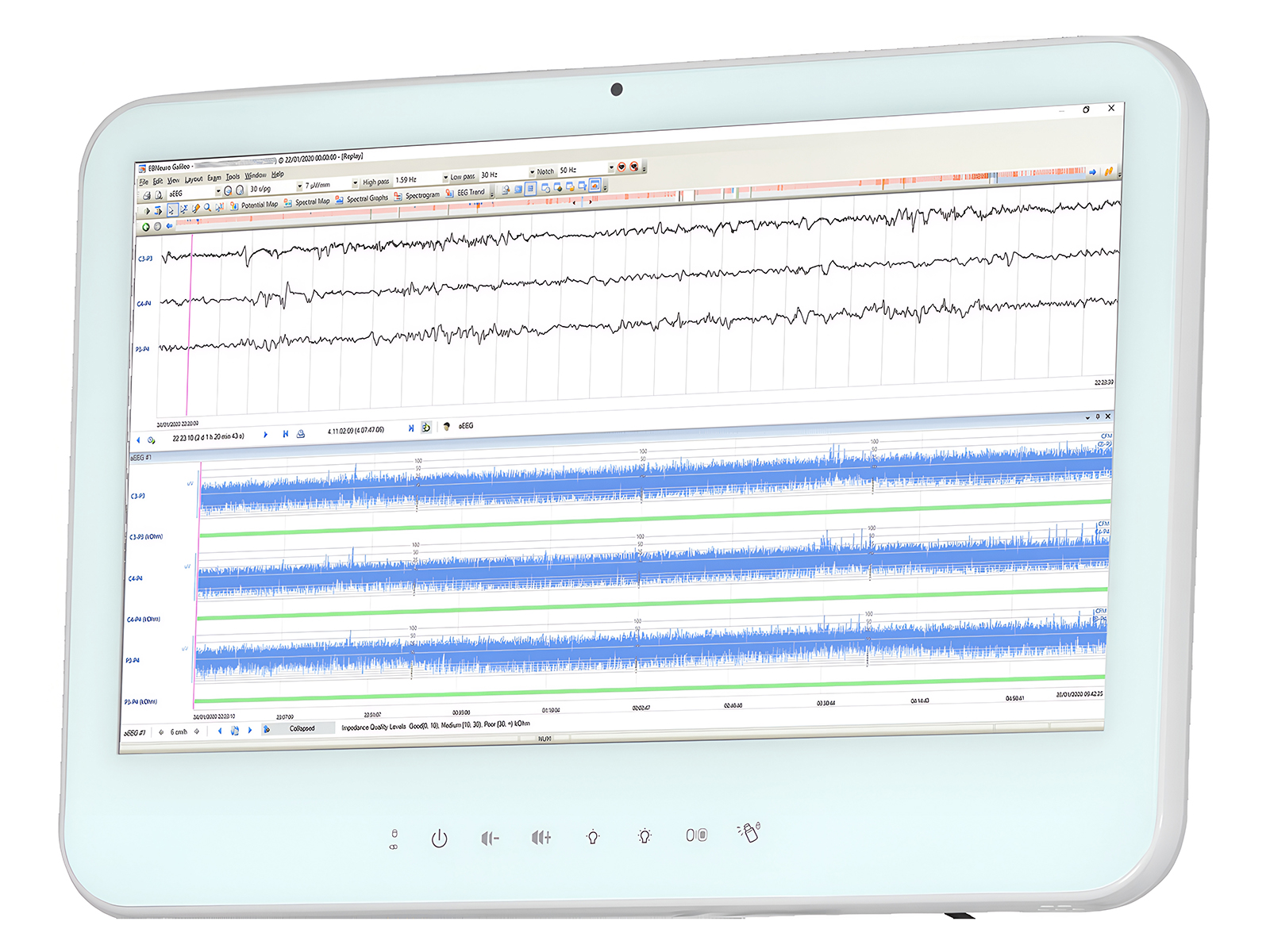 Be Micro (CFM Version) EB Neuro
