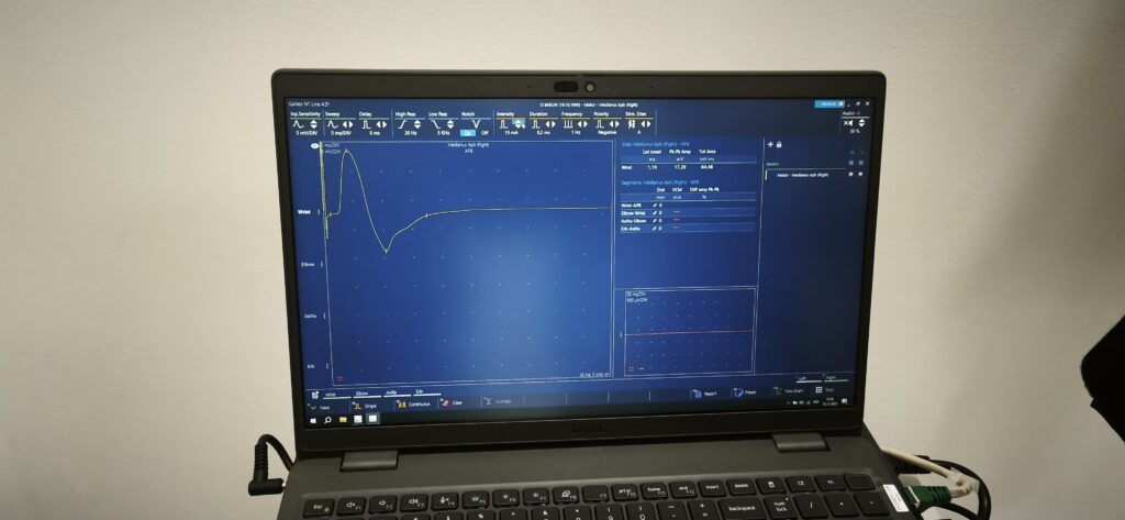 Діагностика EB Neuro у Львівській психіатричній лікарні