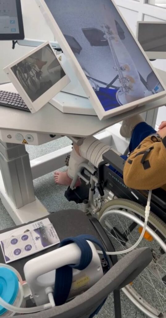 Дзеркальна терапія IVS4