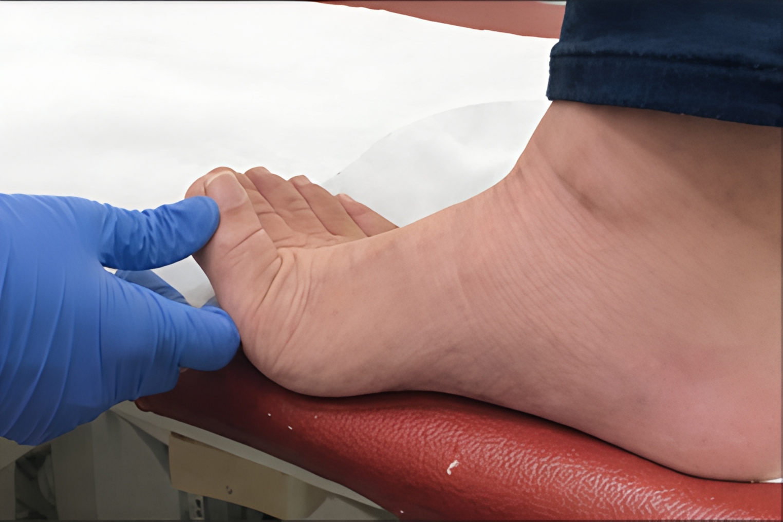 Клінічна діагностика плантарного фасціїту